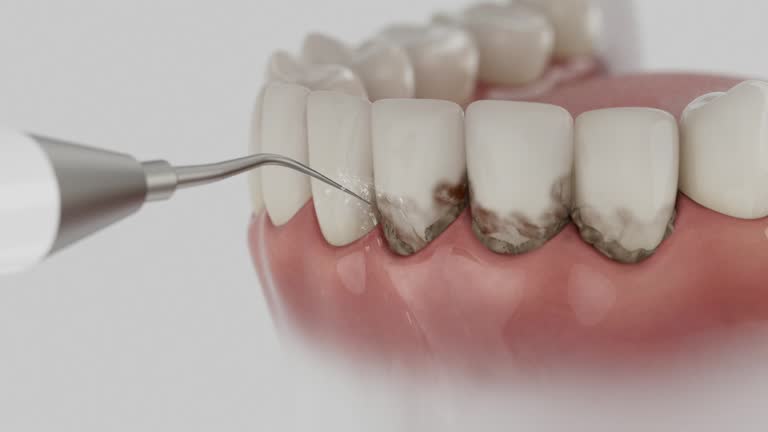 Trusted Root Canal Treatment service in Nashville, IN - Dentist Open Now